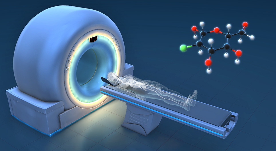 Kako radi? - PET-CT