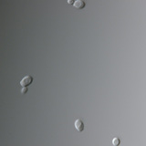 Gljivica candida (najčešći uzročnik vaginalne infekcije)