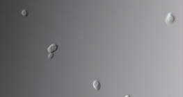 Gljivica candida (najčešći uzročnik vaginalne infekcije)