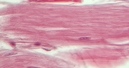 Tetiva (uzdužni presjek)