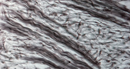 Vlaknasta hrskavica (nos zametka svinje)