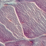 Tetiva (poprečni presjek)