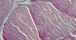 Tetiva (poprečni presjek)