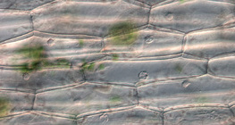 Stanice epiderme biljke