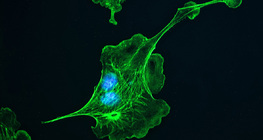 Stanični kostur (citoskelet)