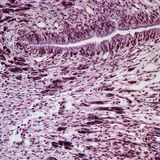 Poprečni presjek stopala puža