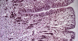 Poprečni presjek stopala puža