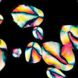 Granule škroba u krumpiru