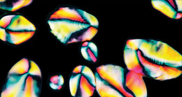 Granule škroba u krumpiru