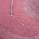 Presjek malog mozga čovjeka