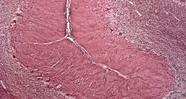 Presjek malog mozga čovjeka