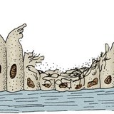 Epitel prekriven cilijama u respiratornom traktu pušača