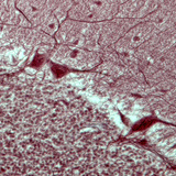 Purkinje neurons (section of human cerebellum)