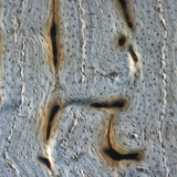 Kost (uzdužni presjek)