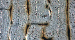 Kost (uzdužni presjek)