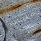 Kost (uzdužni presjek)