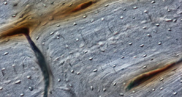 Kost (uzdužni presjek)