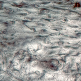 Labavo vezivno tkivo