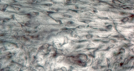 Labavo vezivno tkivo