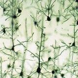 Neuroni moždanog korteksa