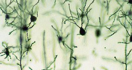 Neuroni moždanog korteksa