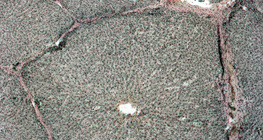 Presjek kroz jetra (svinja)