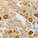 Živčane stanice u gangliju kralježnične moždine