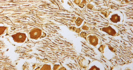 Živčane stanice u gangliju kralježnične moždine