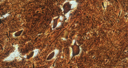 Živčane stanice u kralježničnoj moždini (govedo)