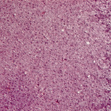 Nadbubrežna žlijezda