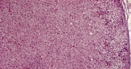 Nadbubrežna žlijezda