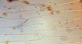 Stanice mesnatog unutrašnjeg lista luka