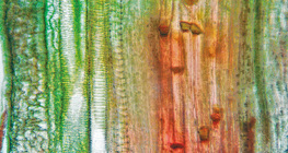 Podužni presjek biljnog vaskularnog tkiva (stabiljka bundeve)