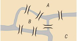 Sedam mostova Königsberga