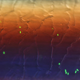 Fluorescentne bakterije E. coli na vlasi kose