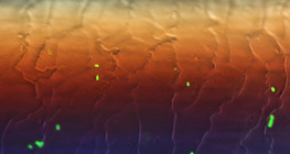 Fluorescentne bakterije E. coli na vlasi kose