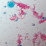 Uzročnik tuberkoloze (TBC) (Mycobacterium tuberculosis)