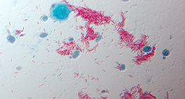 Uzročnik tuberkoloze (TBC) (Mycobacterium tuberculosis)