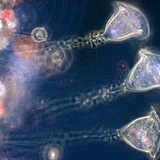 Vorticela (slatkovodna praživotinja)