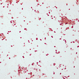 Uzročnik gonoreje, Neisseria gonorrhoeae