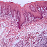 Poprečni presjek jezika (čovjek)