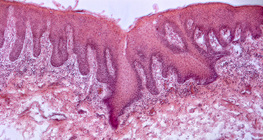 Poprečni presjek jezika (čovjek)