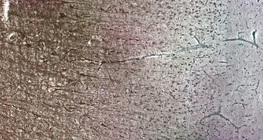 Ljudska moždana kora, različiti slojevi stanica