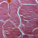 Presjek štitnjače