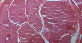 Presjek štitnjače