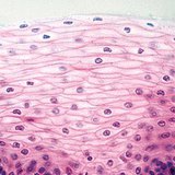 Ne-keratinizirano stratificirano skvamozno tkivo