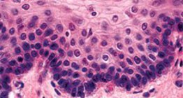 Ne-keratinizirano stratificirano skvamozno tkivo