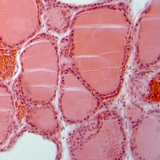 Presjek štitnjače