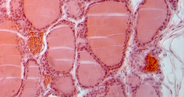 Presjek štitnjače