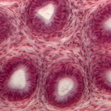 Presjek sjemenskih kanalića